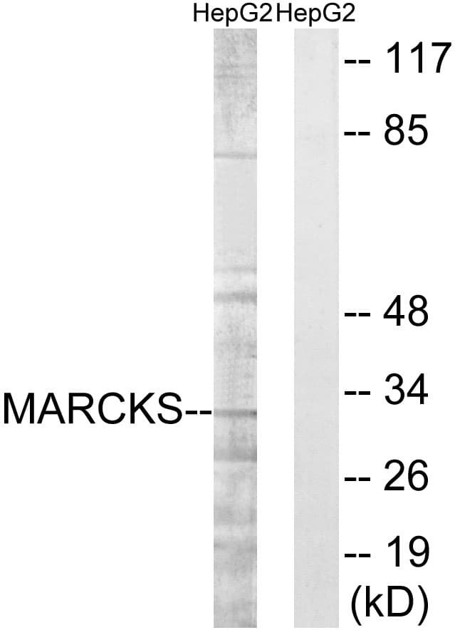 IHC-plus™ MARCKS Antibody (aa136-185)