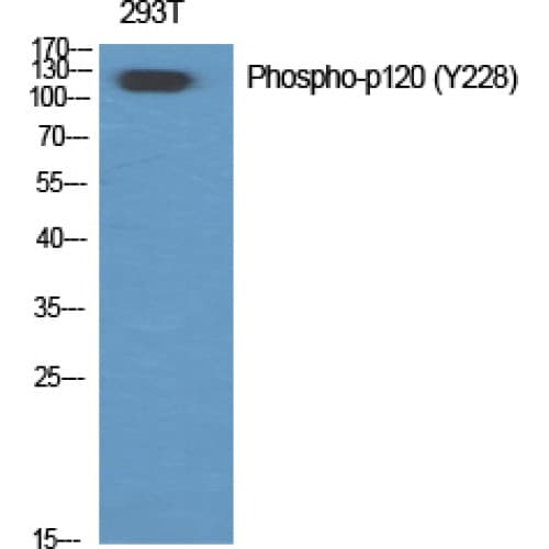 CTNND1 / p120 Catenin Antibody (180-260 aa)