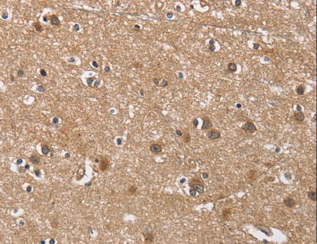 BUB1 Antibody