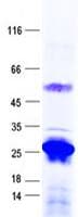 Human KRCC1 Protein (Recombinant His, N-Terminal)