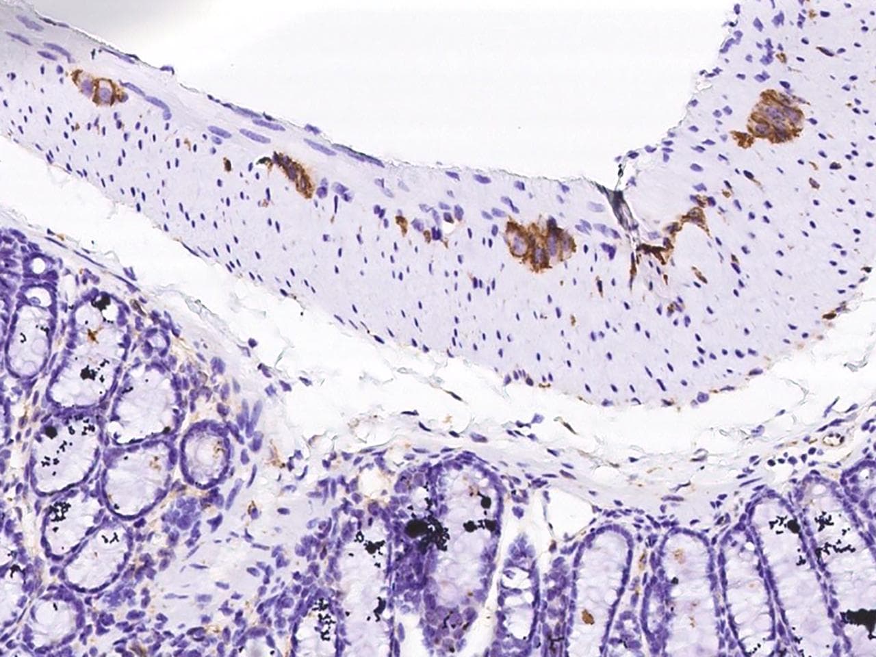 Polyclonal Rabbit anti-Mouse NCAM / CD56 Antibody (Preservative Free, IHC)