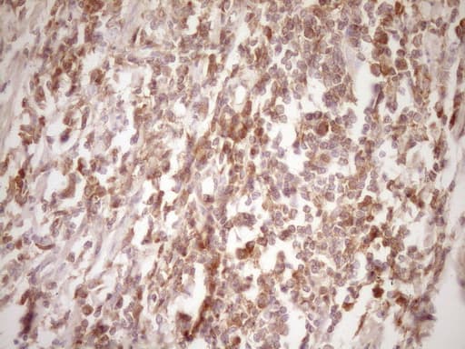 ERBB3 / HER3 Antibody (clone OTI3E10)