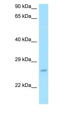 RPS3 / Ribosomal Protein S3 Antibody (aa116-165)