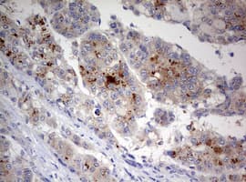 STK11 / LKB1 Antibody (aa1-236, clone OTI0A3)