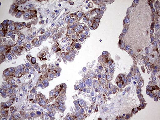 GBA / Glucosidase Beta Acid Antibody (aa40-315, clone UMAB171)
