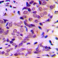 AKT1 + AKT2 + AKT3 Antibody (Internal)