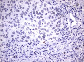 MDM2 Antibody (aa119-438, clone OTI1E5)