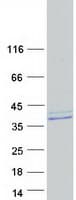 Human KIAA0152 / MLEC Protein (Recombinant Myc-DDK (Flag))