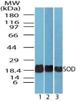IHC-plus™ Superoxide Dismutase Antibody