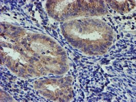 PDSS2 / DLP1 Antibody (clone OTI1C11)