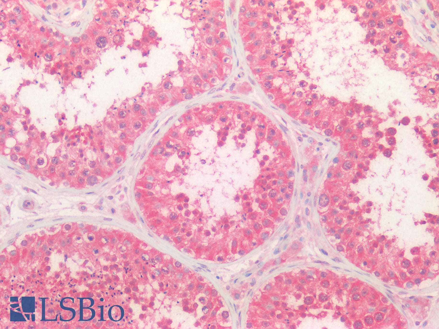 IHC-plus™ Polyclonal Rabbit anti-Human CTSK / Cathepsin K Antibody (IHC)