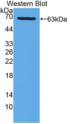 XDH / Xanthine Oxidase Antibody (aa1-300)