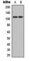 IHC-plus™ ATXN1 / SCA1 Antibody (C-Terminus)