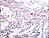 Polyclonal Rabbit anti-Human RELA / NFKB p65 Antibody (IHC, WB)