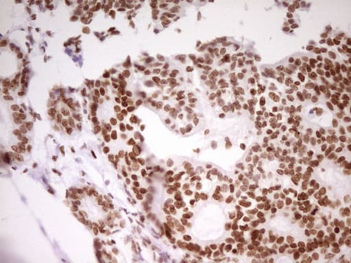 Monoclonal Mouse anti-Human SP110 Antibody (clone OTI4C1, Carrier-free, aa232-521, IHC, WB)
