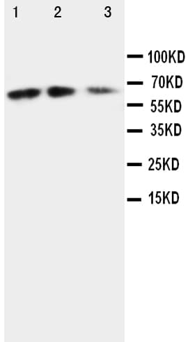 Polyclonal Rabbit anti-Mouse CX3CL1 / Fractalkine Antibody (aa74-92, IHC, WB)