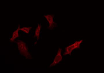 MKNK1 / MNK1 Antibody