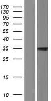 HRASLS5 Protein (Over-Expression Lysate Myc-DDK (Flag))