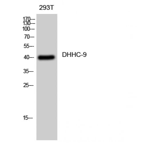 ZDHHC9 Antibody (310-390 aa, C-terminal)