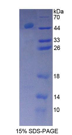 Rat BTK Protein (Recombinant His-GST)