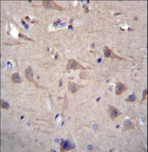 CCT8 Antibody (aa519-548)