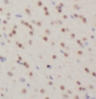 FTO Antibody