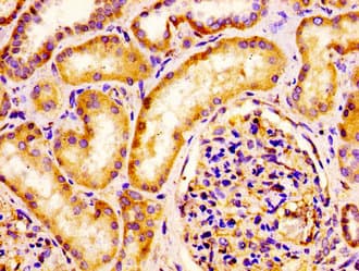 IQCB1 Antibody