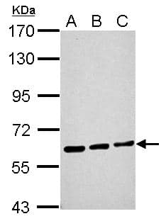 ME1 / Malate Dehydrogenase Antibody (aa161-519)