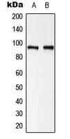 IHC-plus™ Polyclonal Rabbit anti-Human CTNNB1 / Beta Catenin Antibody (N-Terminus, IHC, WB)