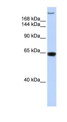 Polyclonal Rabbit anti-Human TNRC6A / GW182 Antibody (N-Terminus, WB)
