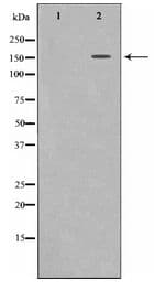 KDR / VEGFR2 / FLK1 Antibody