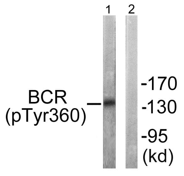 CML / BCR Antibody (phospho-Tyr360)