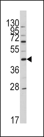 Apolipoprotein A-V Antibody (aa22-52)