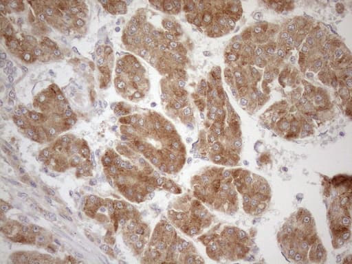 CPM / Carboxypeptidase M Antibody (aa124-423, clone OTI6C8)