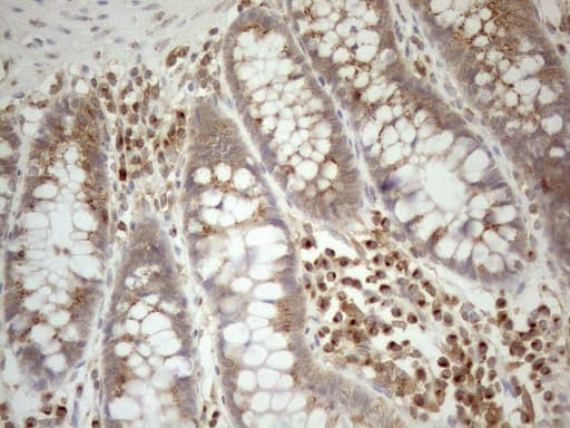 ZNF69 Antibody (clone OTI3C3)