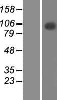 TFIP11 Protein (Over-Expression Lysate Myc-DDK (Flag))