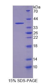 Human CNTNAP5 Protein (Recombinant)