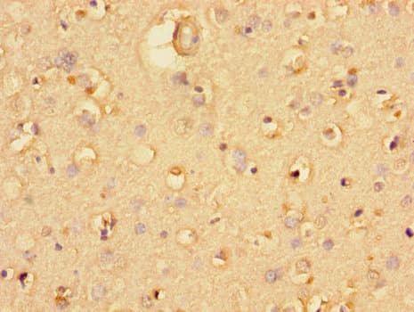 UBE1L2 / UBE1L2 Antibody