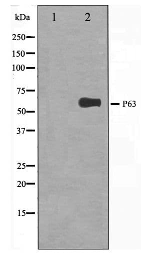 TP63 / p63 Antibody