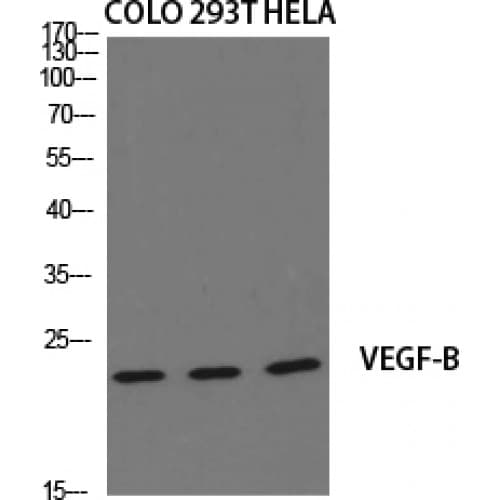 IHC-plus™ Polyclonal Rabbit anti-Human VEGFB Antibody (60-140 aa, Internal, IHC, WB)