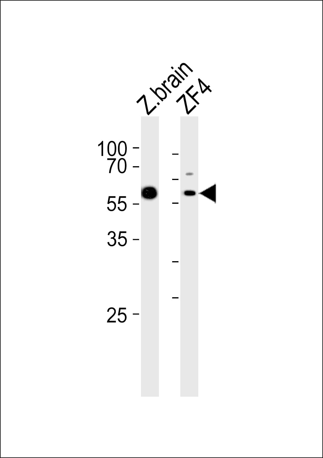 PAPL Antibody (aa378-413)