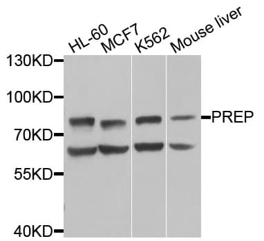 PREP / Prolyl Endopeptidase Antibody