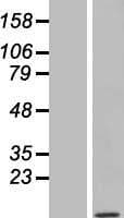 TOMM7 Protein (Over-Expression Lysate Myc-DDK (Flag))