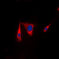 Polyclonal Rabbit anti-Human KSR1 Antibody (Internal, IHC, IF, WB)