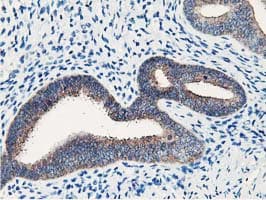NUDT18 Antibody (clone OTI1A5)