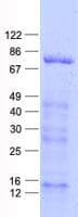 Human ARHGAP22 / RhoGAP2 Protein (Recombinant His, N-Terminal)