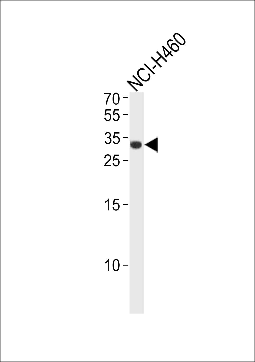 ASCL1 / MASH1 Antibody (aa63-90)