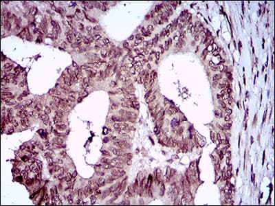 Monoclonal Mouse anti-Human ZEB1 / AREB6 Antibody (clone 2A8A6, aa967-1108, IHC, IF, WB)