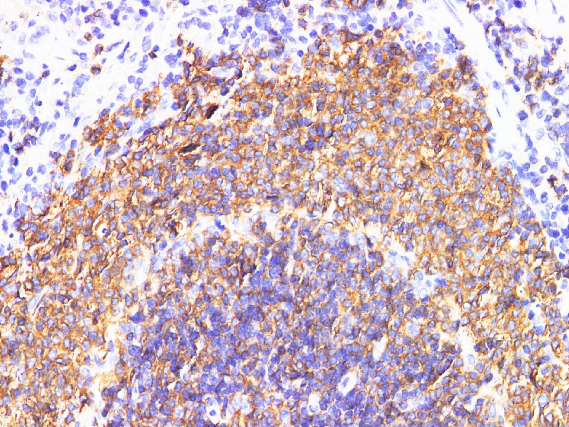 IL6R / IL6 Receptor Antibody