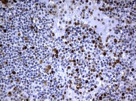 Monoclonal Mouse anti-Human PCNA Antibody (clone OTI1D11, IHC, WB)